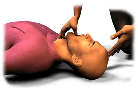 To releive an airway obstruction on an unconscious victim, begin CPR.